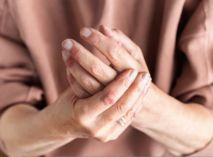 dry-hands