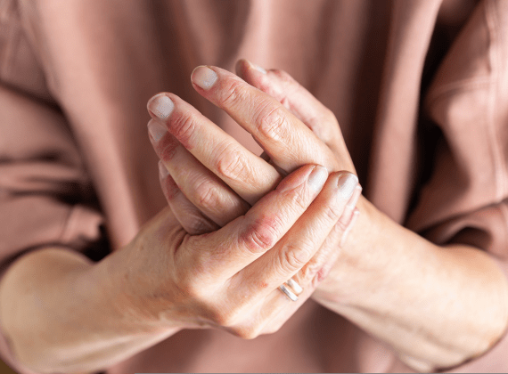 dry-hands